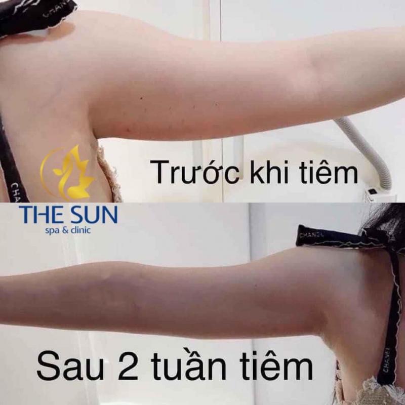 The Sun Spa & Clinic
