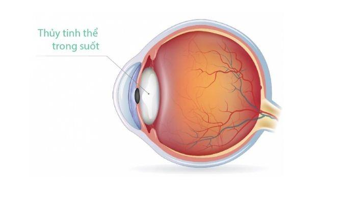 Phương pháp mới giúp những người có bệnh về mắt không phải đeo kính
