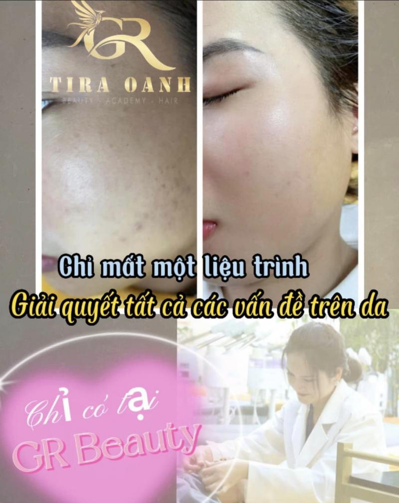 Tira Oanh - GR Beauty