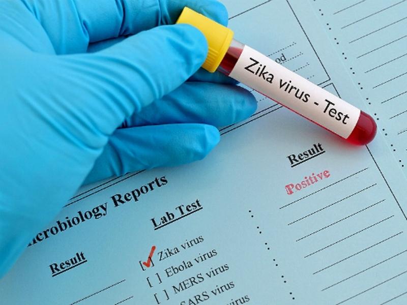 Xét nghiệm bệnh virut Zika