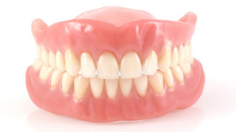 Răng giả tháo lắp là gì?
