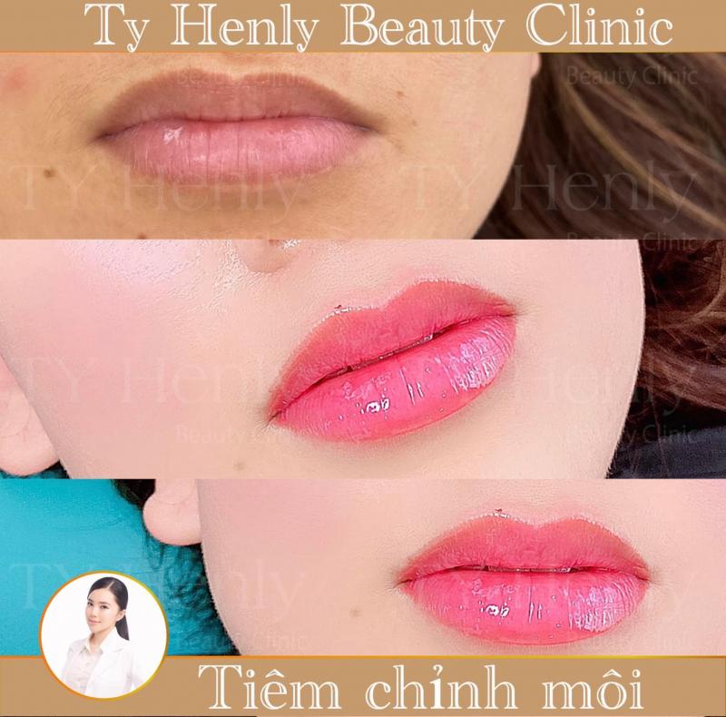 Ty Henly Beauty Clinic