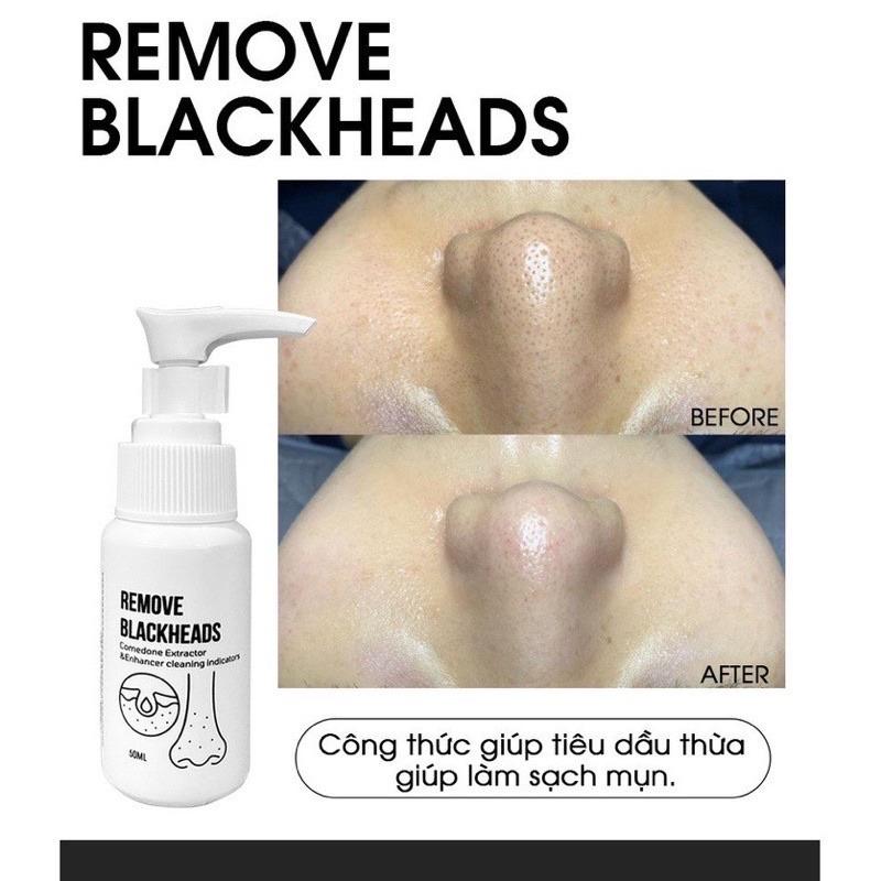 Ủ mụn đầu đen Removes BlackHeads