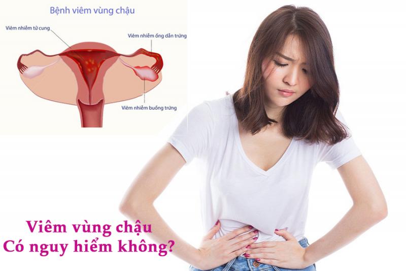Một số nghiên cứu cho thấy phụ nữ thụt rửa âm đạo thường xuyên sẽ có nhiều nguy cơ bị bệnh viêm vùng chậu