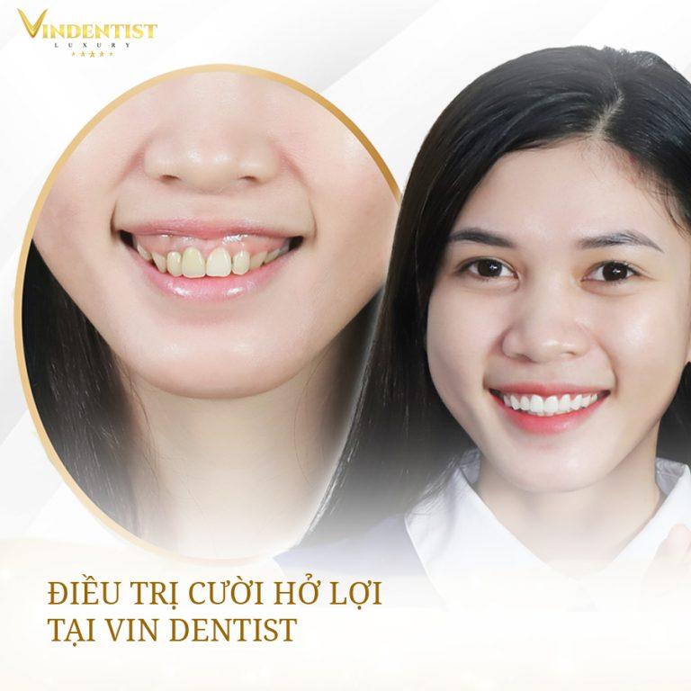 VIN Dentist - Nha Khoa Thẩm Mỹ Số 1 Đà Nẵng