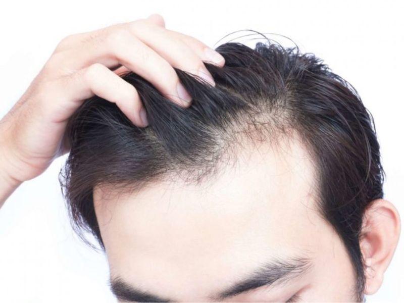 Vitamin E dưỡng tóc giúp tóc mọc dày