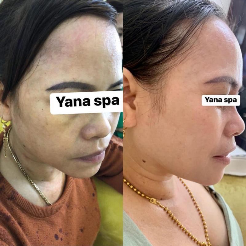 Yana Clinic & Spa